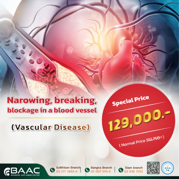 หลอดเลือดตีบแตกตัน - Vascular Therapy - Image 2