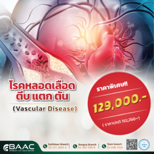 หลอดเลือดตีบแตกตัน - Vascular Therapy